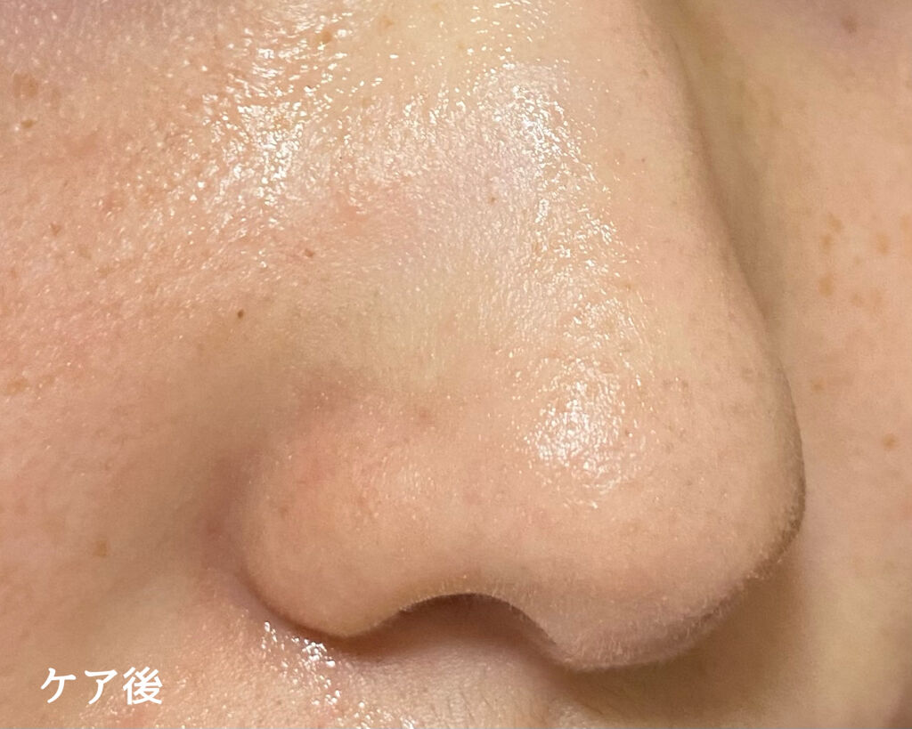 3ステップソクソクノーズパック/MEDIHEAL/シートマスク・パックを使ったクチコミ（3枚目）