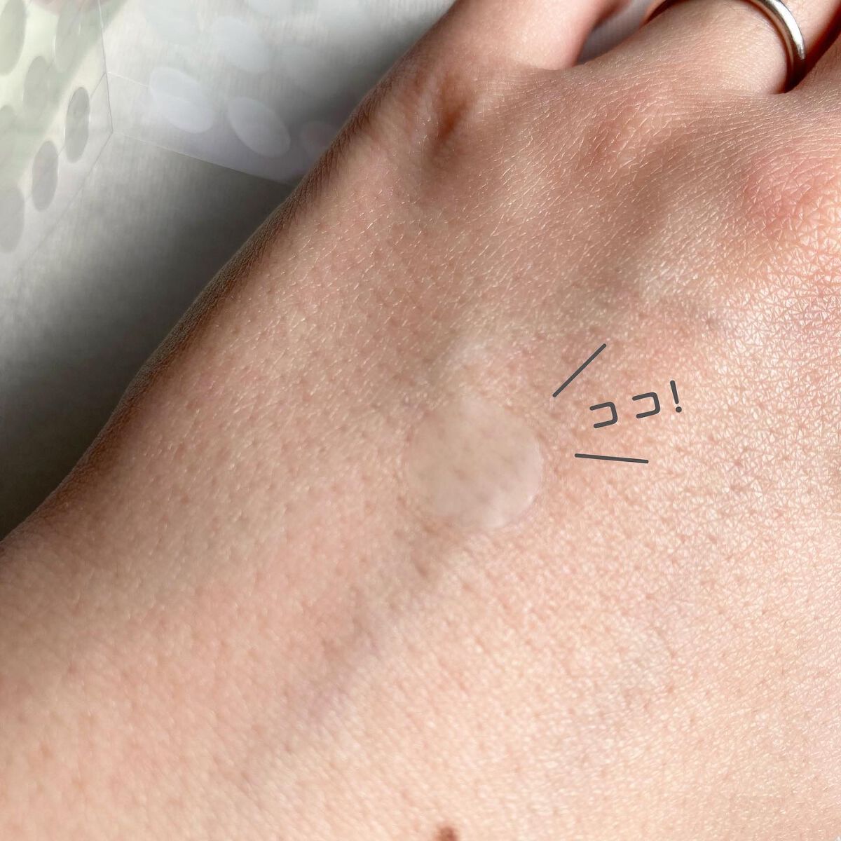 ごめんね素肌 キニナルマスク/クリアターン/シートマスク・パックを使ったクチコミ(4枚目)