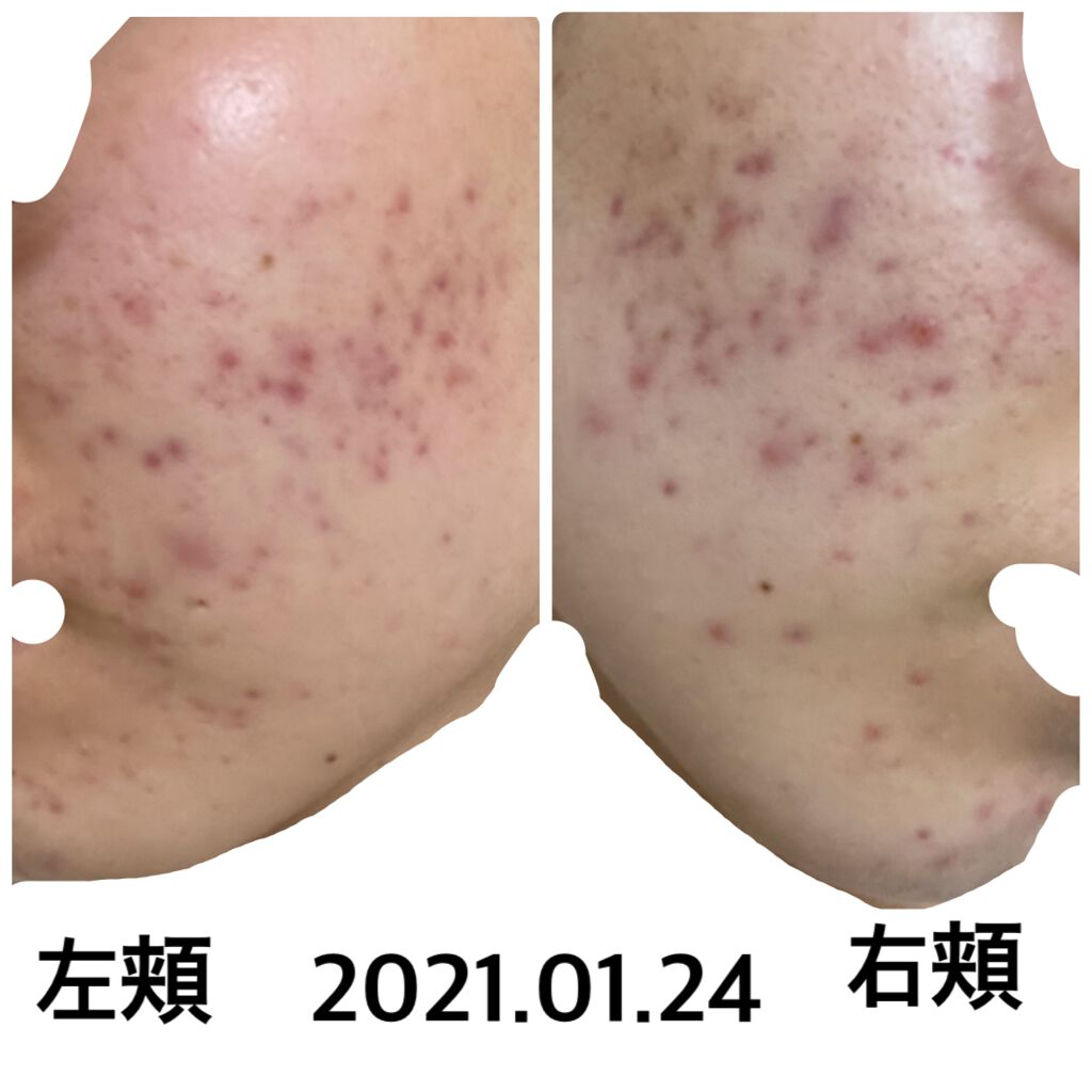 ミノン アミノモイスト モイストチャージ ミルク/ミノン/乳液を使ったクチコミ(1枚目)