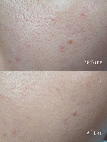 キル カバー フィクサー クッション/CLIO/クッションファンデーションを使ったクチコミ(2枚目)