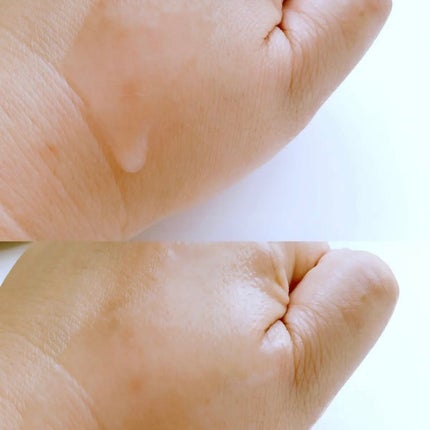 ピンクティーツリーシナジーセラム/APLIN/美容液を使ったクチコミ(4枚目)