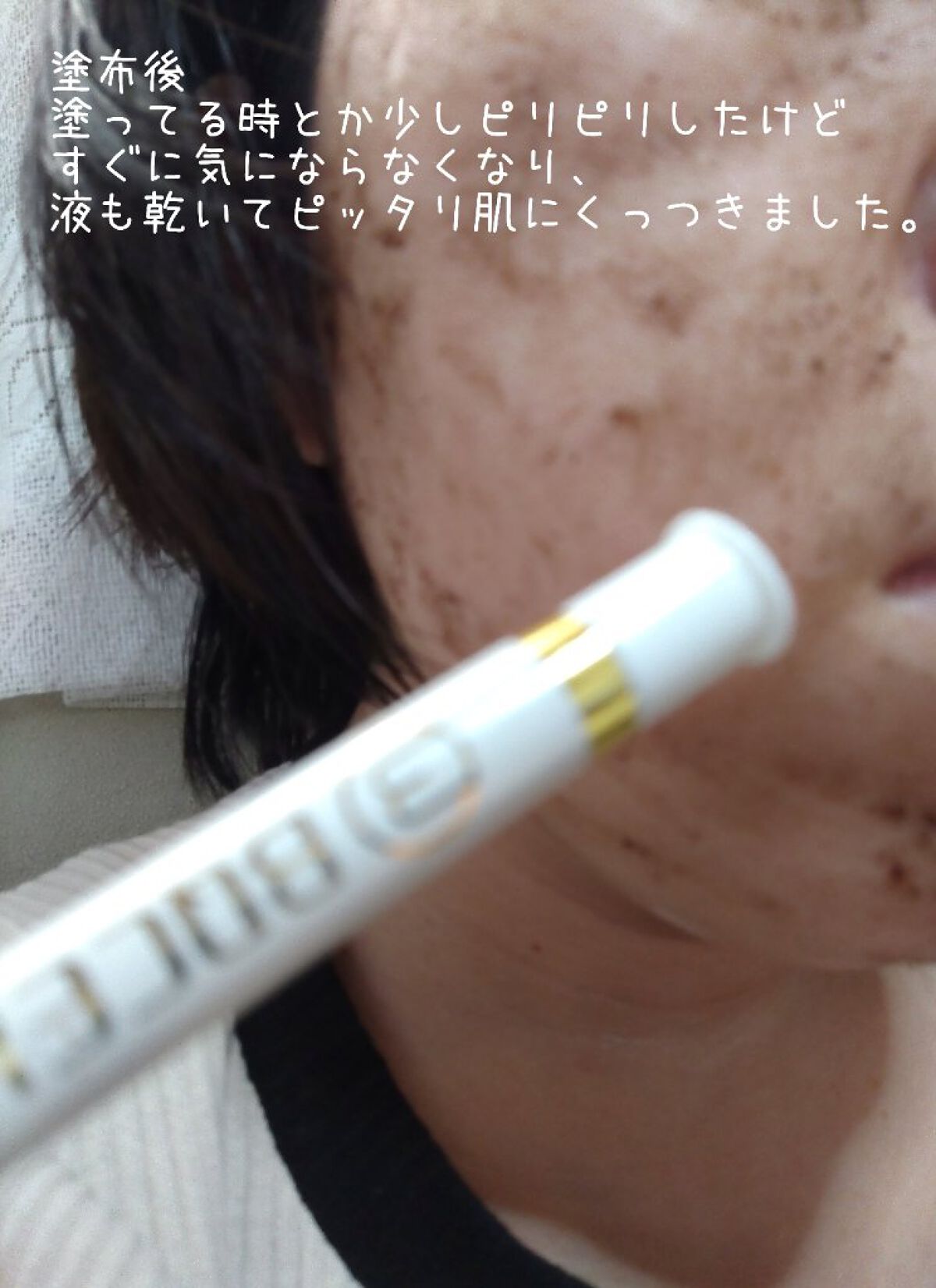 ダーマスキンピーリング/BQCELL/その他キットセットを使ったクチコミ（2枚目）