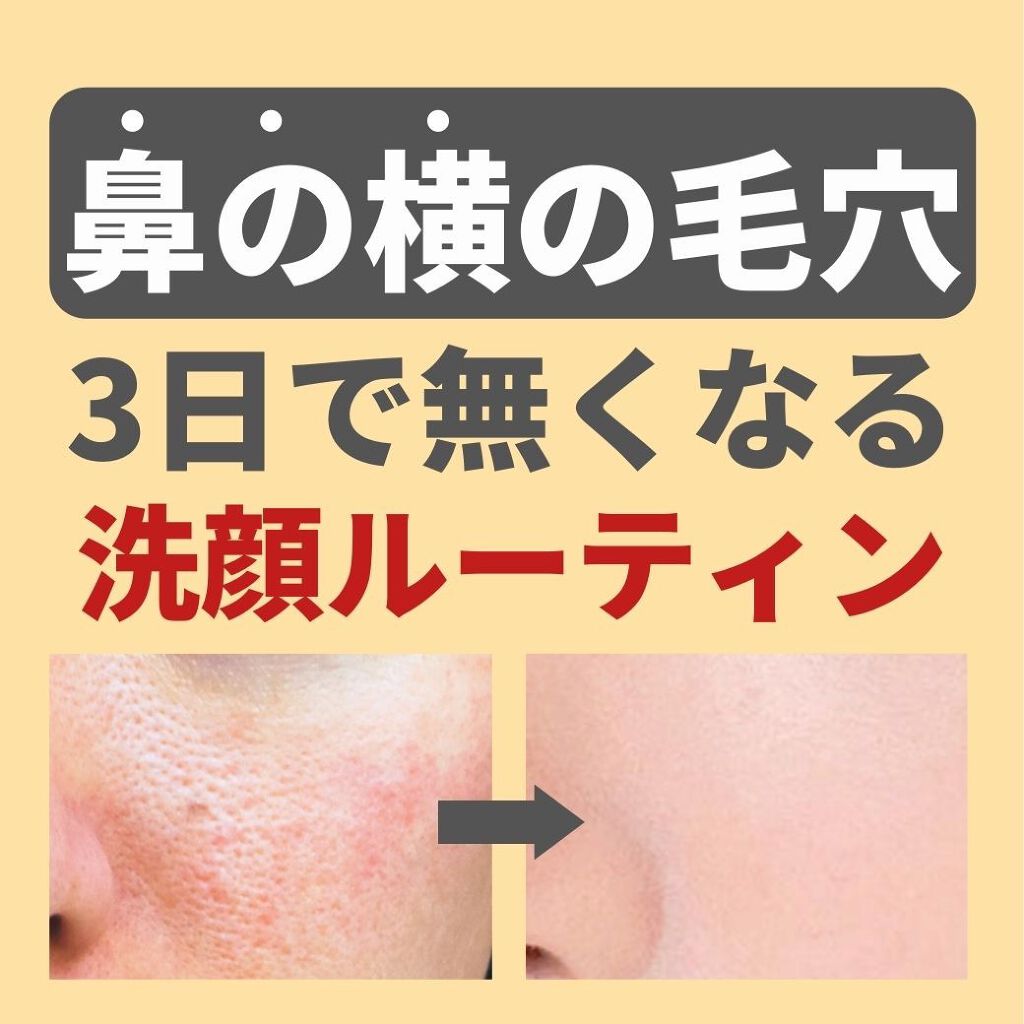 あなたの肌に合ったスキンケア💐コーくん先生 on LIPS 「鼻の横の毛穴って気になりますよね🥺『よかった!!』『超タメにな..」(1枚目)