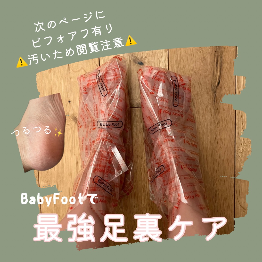 イージーパックDP60分タイプ 60分タイプ Sサイズ/ベビーフット/レッグ・フットケアを使ったクチコミ（1枚目）