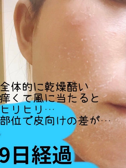 ミラミン/ZO Skin Health/フェイスクリームを使ったクチコミ(7枚目)