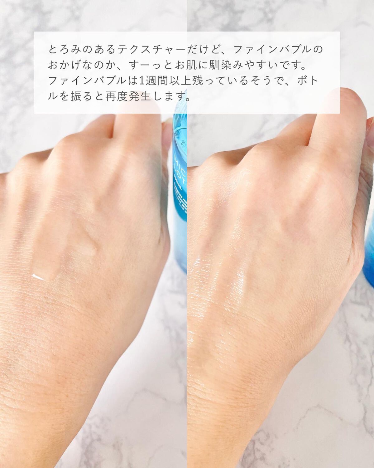 薬用マイクロバブルローション/Macchia Label/化粧水を使ったクチコミ（3枚目）