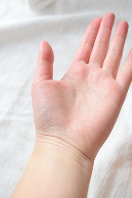 VC100エッセンスローション EX/ドクターシーラボⓇ/化粧水を使ったクチコミ(4枚目)