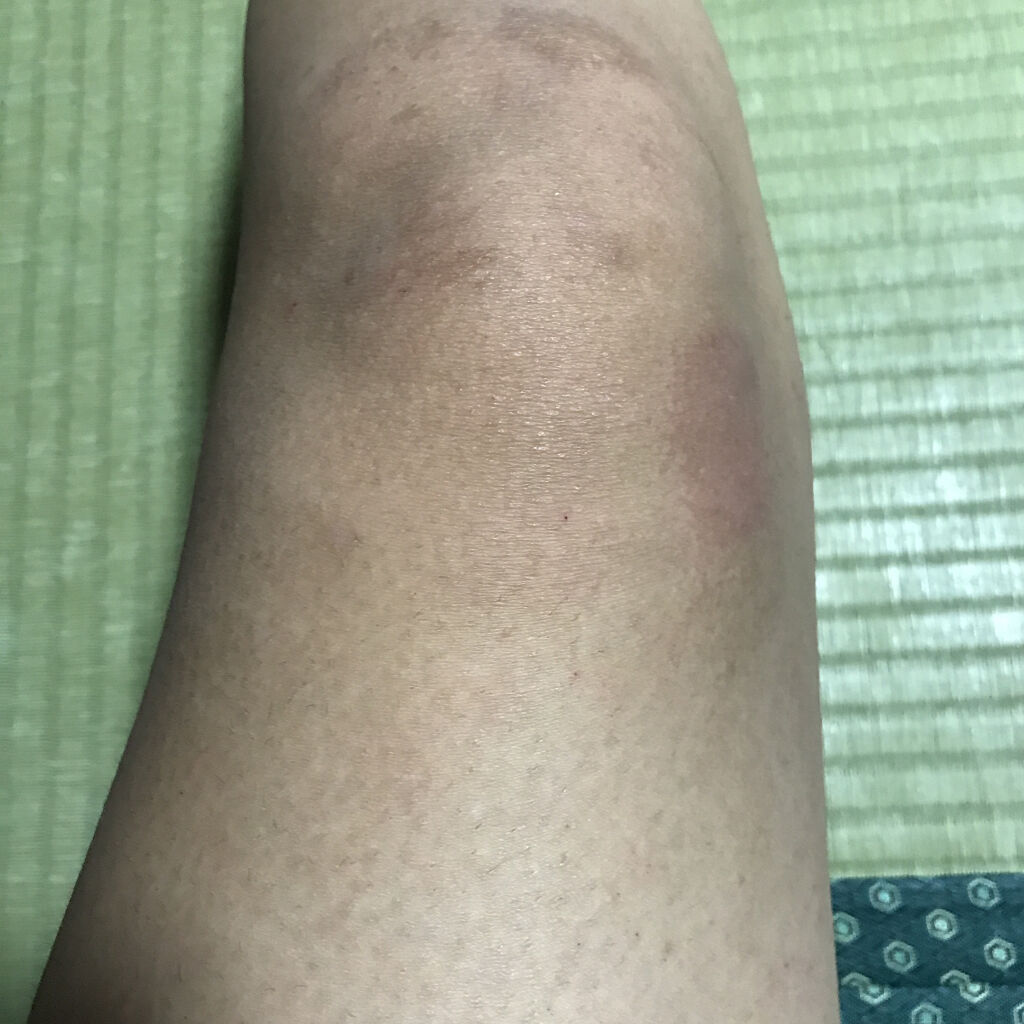 寝ながらメディキュット ロング/メディキュット/着圧ソックス・レギンスを使ったクチコミ（2枚目）