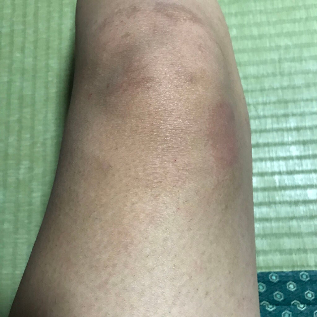 寝ながらメディキュット ロング/メディキュット/着圧ソックス・レギンスを使ったクチコミ(2枚目)