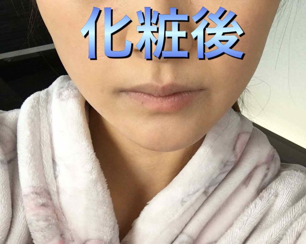 みす on LIPS 「私はほくろが出来やすく、ここ何年かでほくろが増えてきたのでピコ..」(4枚目)