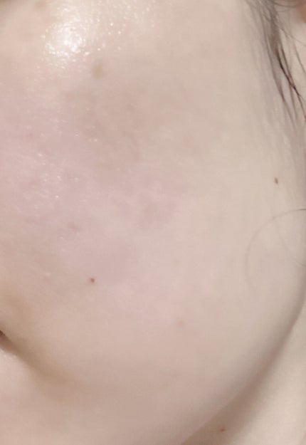 ブライトニングケア ローション M(医薬部外品)/アクアレーベル/化粧水を使ったクチコミ(2枚目)