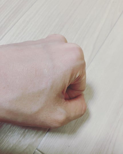 極薄透明パッチ nikipa!/金冠堂/にきびパッチを使ったクチコミ(3枚目)