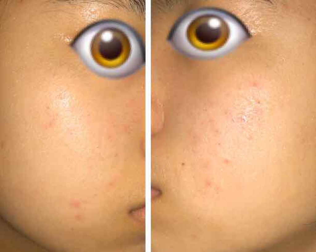 明色美顔水 薬用化粧水/美顔/化粧水を使ったクチコミ（2枚目）