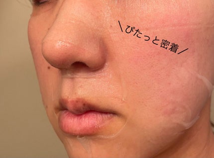 シカアルブチンマスク/NOWATER/シートマスク・パックを使ったクチコミ(5枚目)