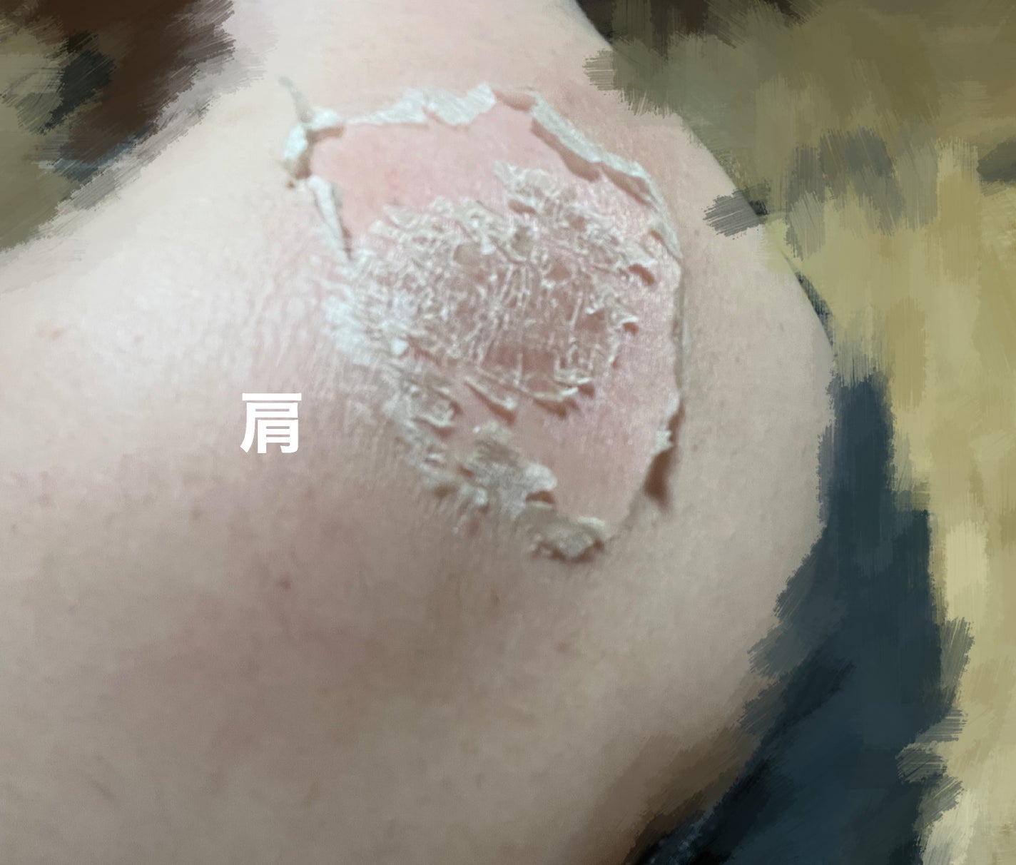 cocハーブピーリング/colingco/その他キットセットを使ったクチコミ(3枚目)