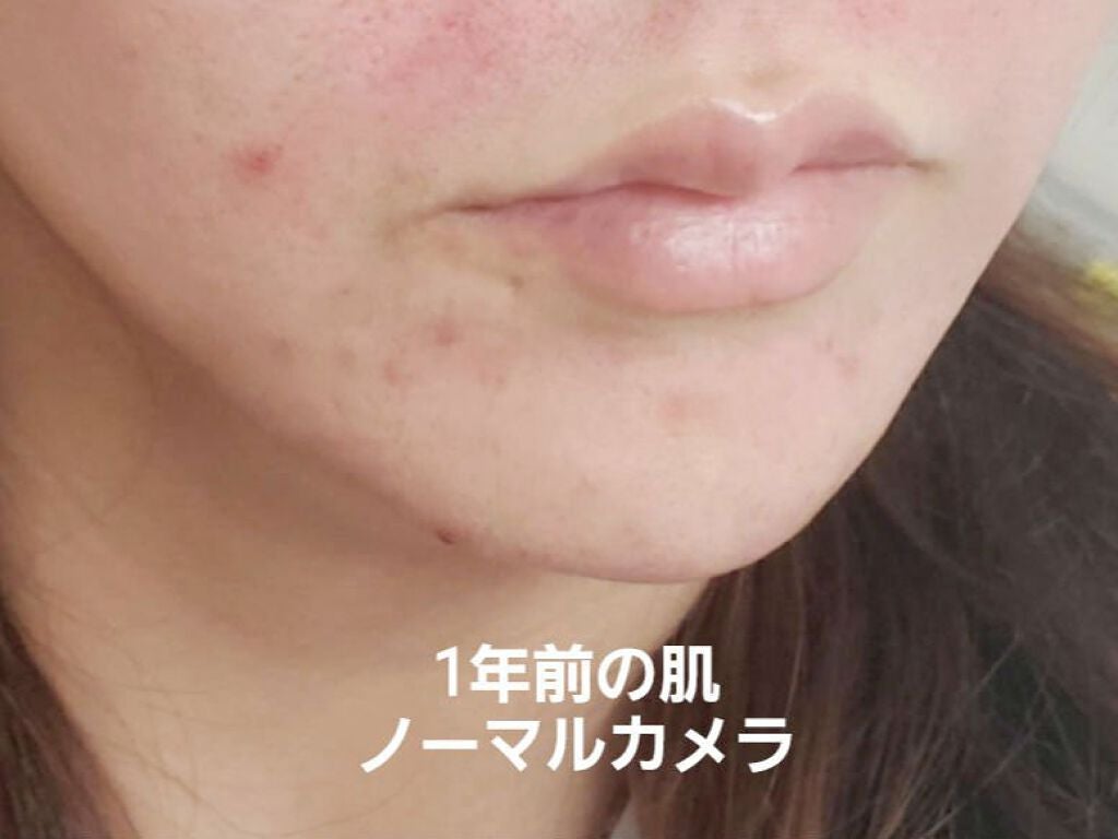 ì€ìâ¡ on LIPS ãðð¡åããããã1幎å
ã§ã®ãŸãšãð¡ð1幎åã®èã»ãããã»ç®èã®..ãïŒ1æç®ïŒ