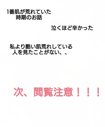 nachan on LIPS 「⚠画像閲覧注意です⚠今日は人類で1番肌荒れしたんじゃないかとい..」(1枚目)