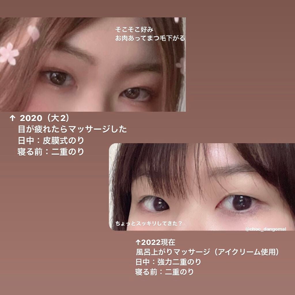 アイビューティー フィクサー WP/アストレア ヴィルゴ/二重まぶた用アイテムを使ったクチコミ(3枚目)