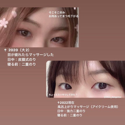 アイビューティー フィクサー WP/アストレア ヴィルゴ/二重まぶた用アイテムを使ったクチコミ(3枚目)