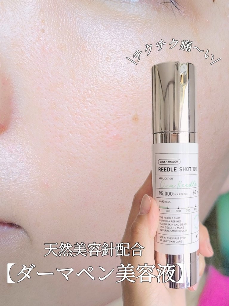 リードルショット100/VT/美容液を使ったクチコミ（1枚目）