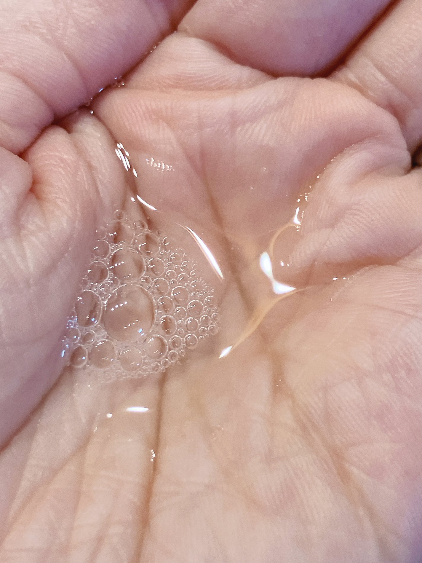 エスト ザ ローション/est/化粧水を使ったクチコミ(3枚目)