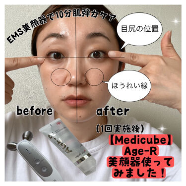 HOT定番人気 メディキューブ 美顔器 medicube AGE-R EMS nt4Yq