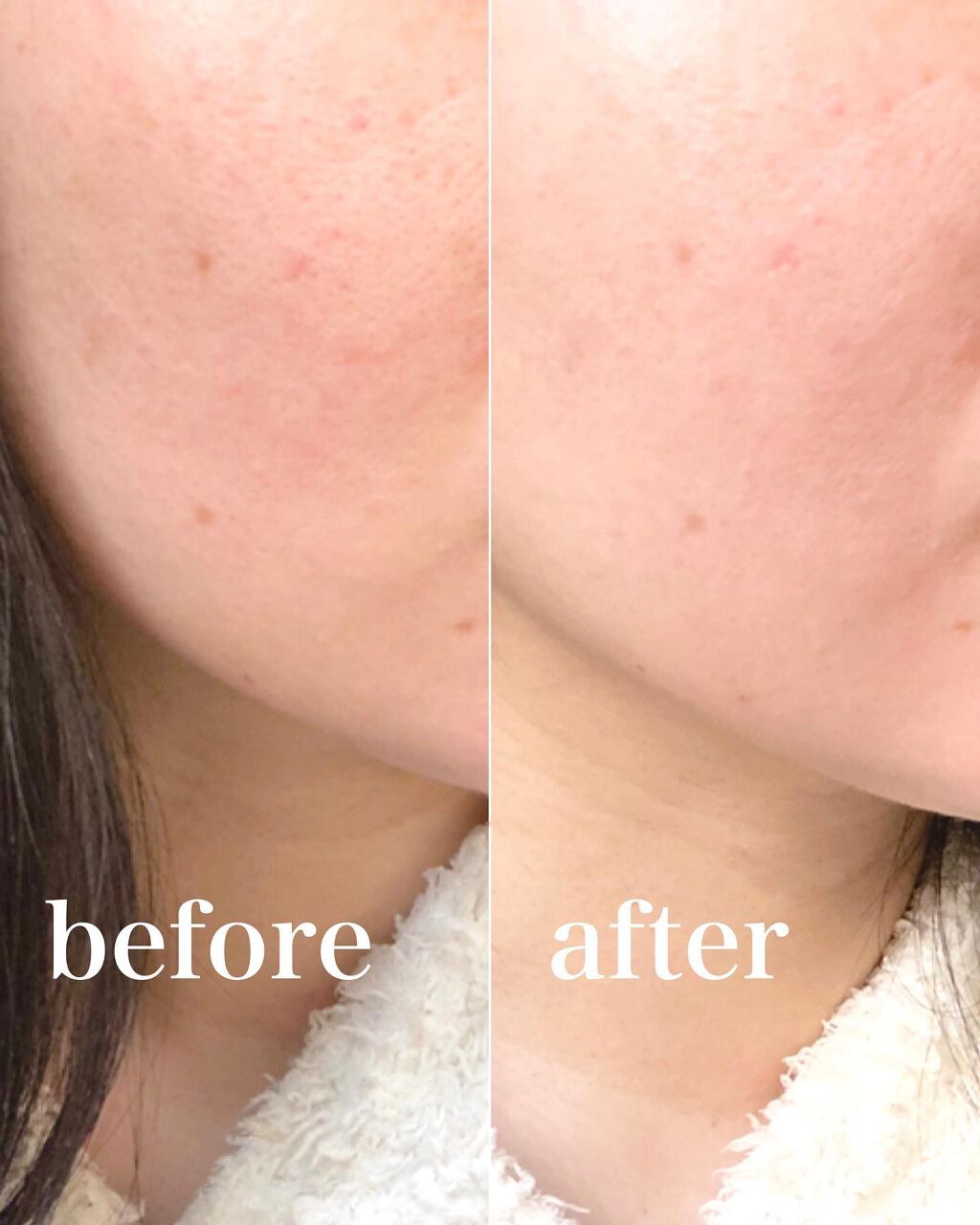 D-UVクリア ホワイトソリューション/アスタリフト/日焼け止めクリームを使ったクチコミ(4枚目)