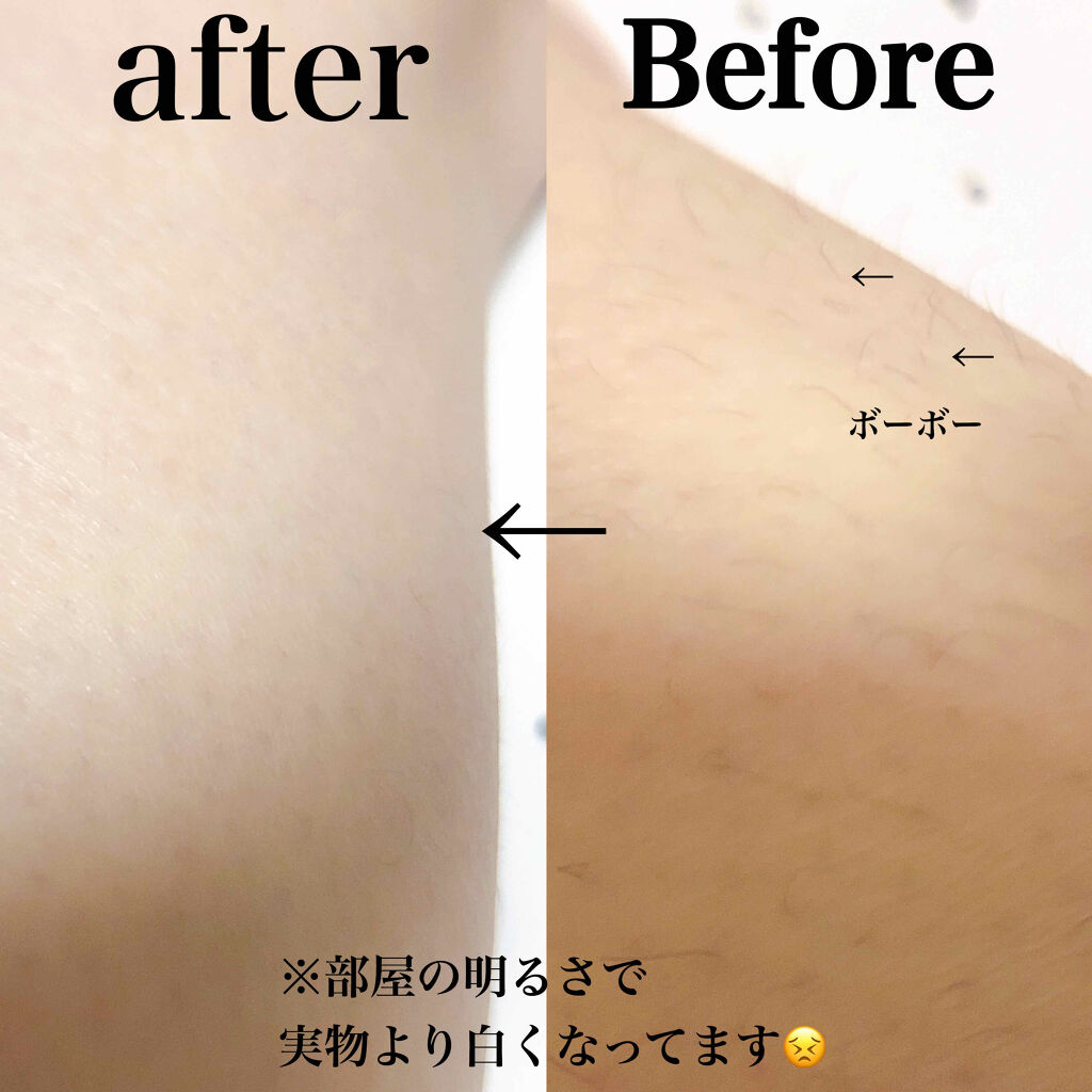 つるすべ除毛パッド/DAISO/ムダ毛ケアを使ったクチコミ（2枚目）