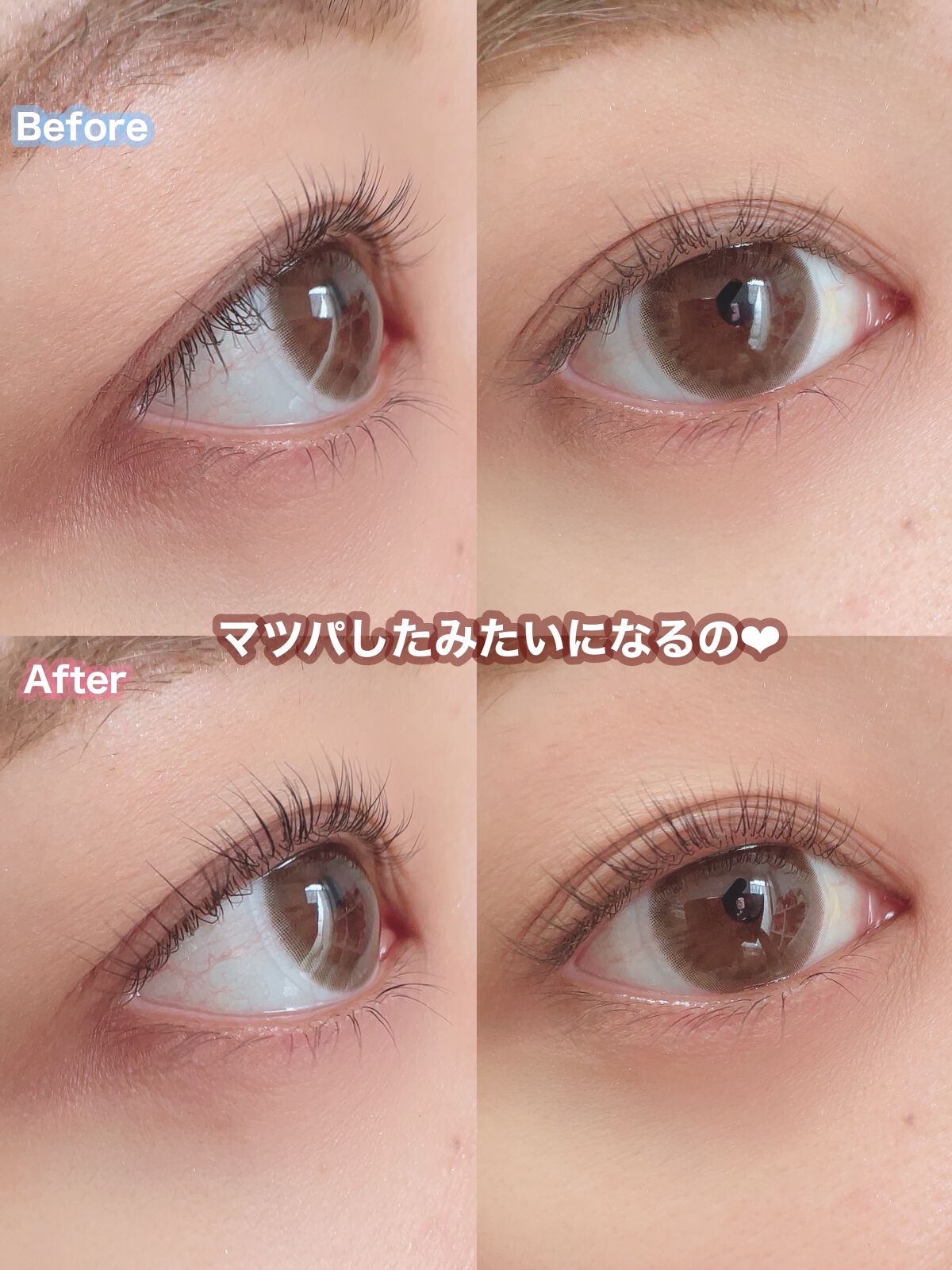 ひとえ・奥ぶたえ用カーラー/アイプチ®/ビューラーを使ったクチコミ（2枚目）