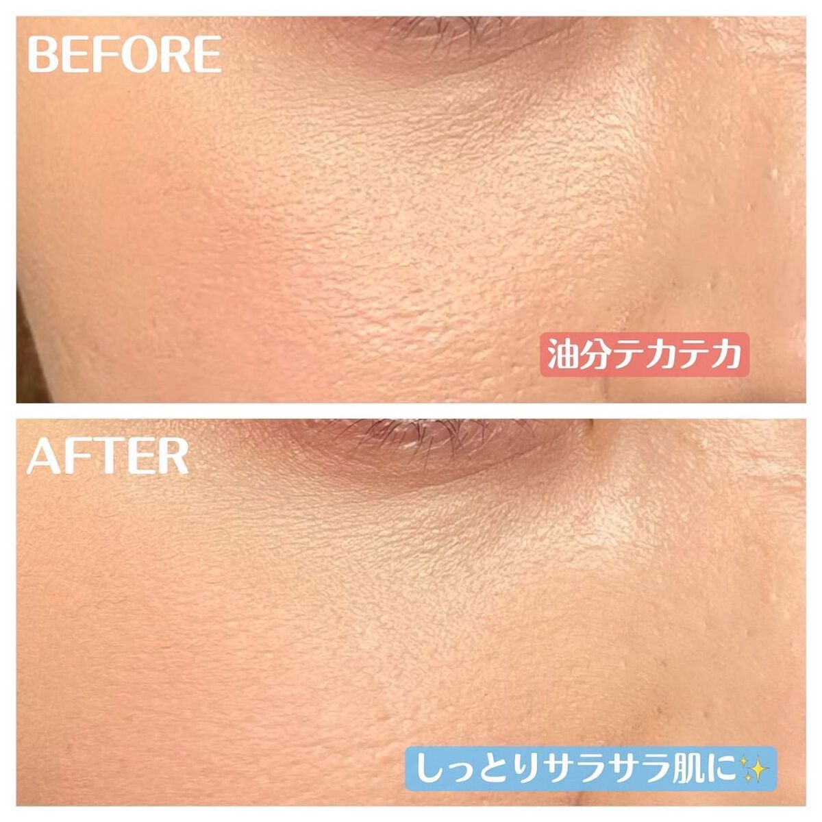 ノーモアブラックヘッド(ノーズピーリング)/One-day's you/スクラブ・ゴマージュを使ったクチコミ(8枚目)