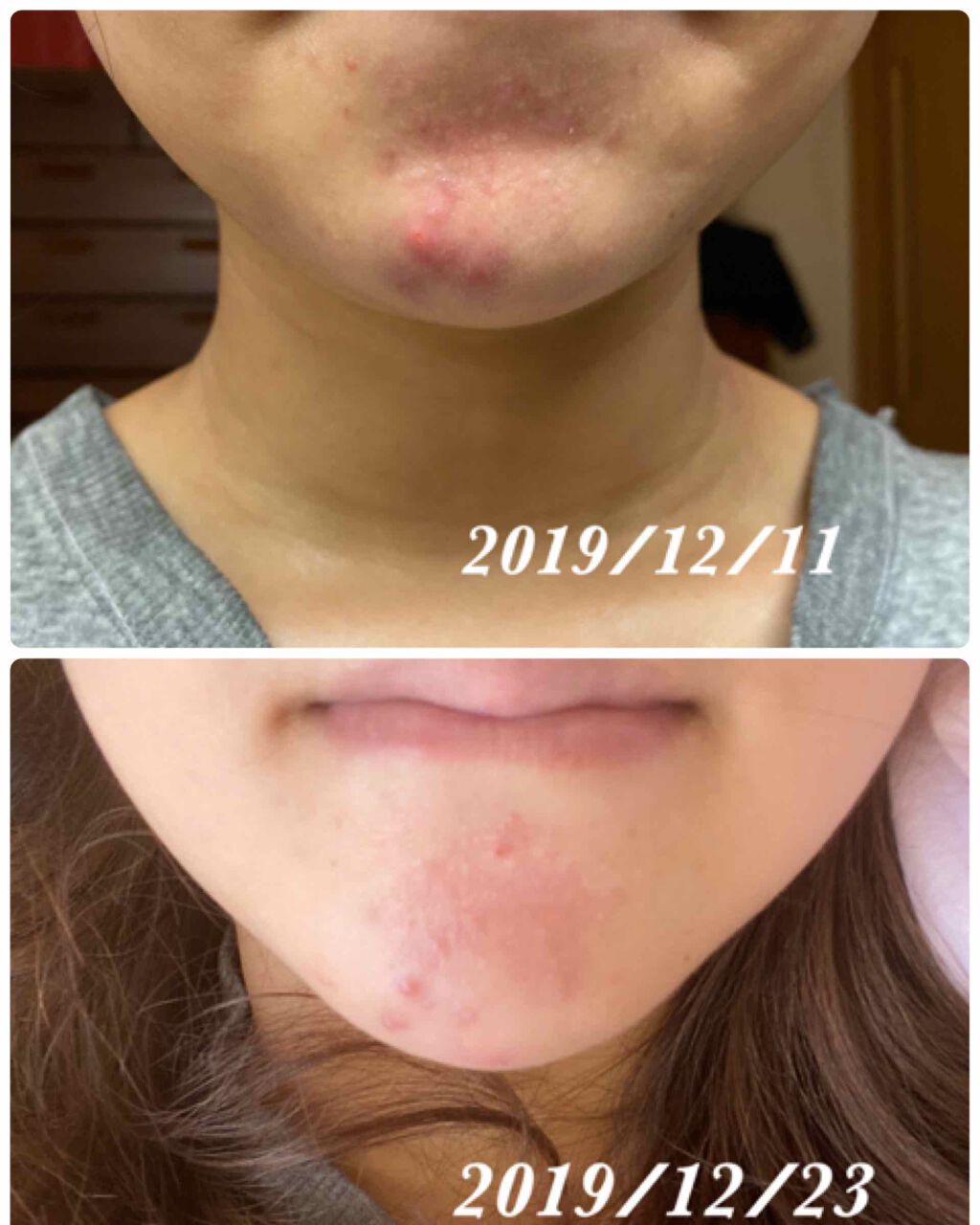 乳液・敏感肌用・しっとりタイプ/無印良品/乳液を使ったクチコミ（3枚目）