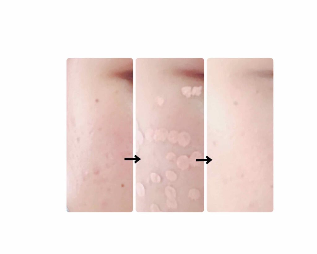 マジックコンシーラー/カリプソ/リキッドコンシーラーを使ったクチコミ（2枚目）