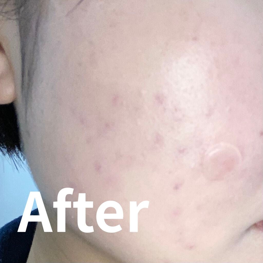 カバーリシャス パワーフィットファンデーション/BANILA CO/リキッドファンデーションを使ったクチコミ(4枚目)