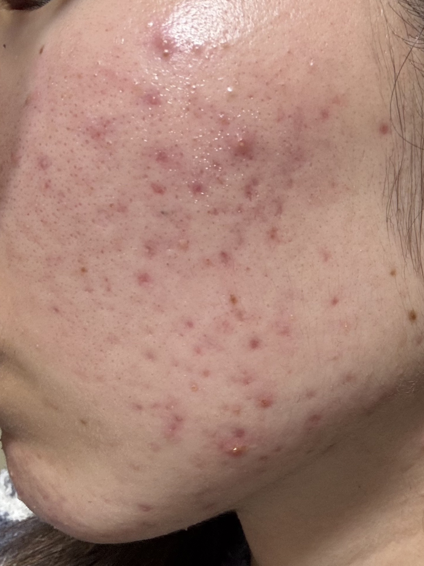 ハーブクリアジェル ピュア/セフィーヌ/ピーリングを使ったクチコミ（2枚目）