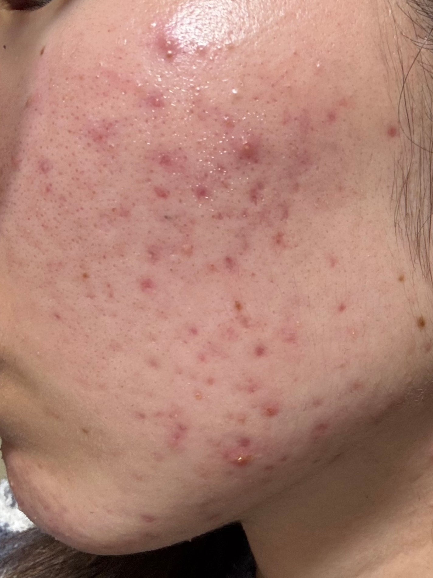 ハーブクリアジェル ピュア/セフィーヌ/ピーリングを使ったクチコミ(2枚目)