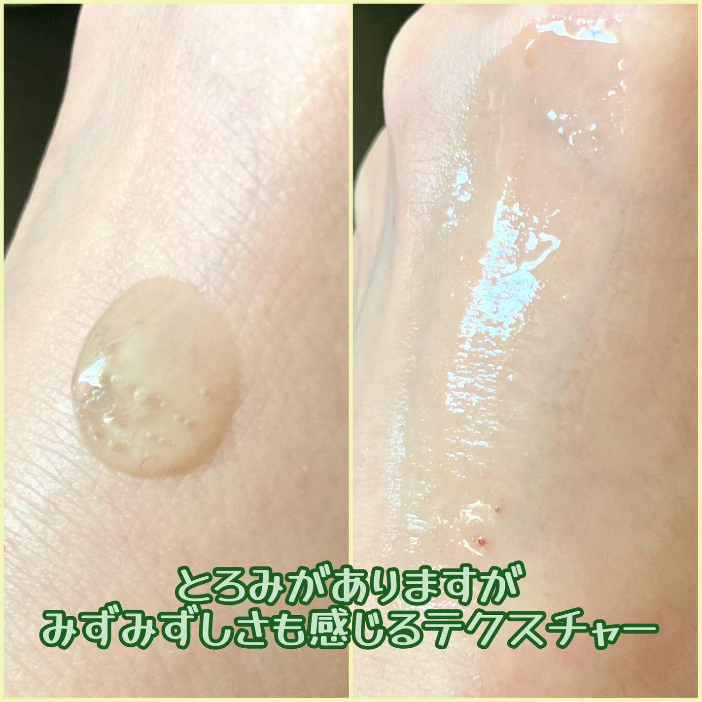 エクソソームシカ アンプル/MEDICUBE/美容液を使ったクチコミ(3枚目)