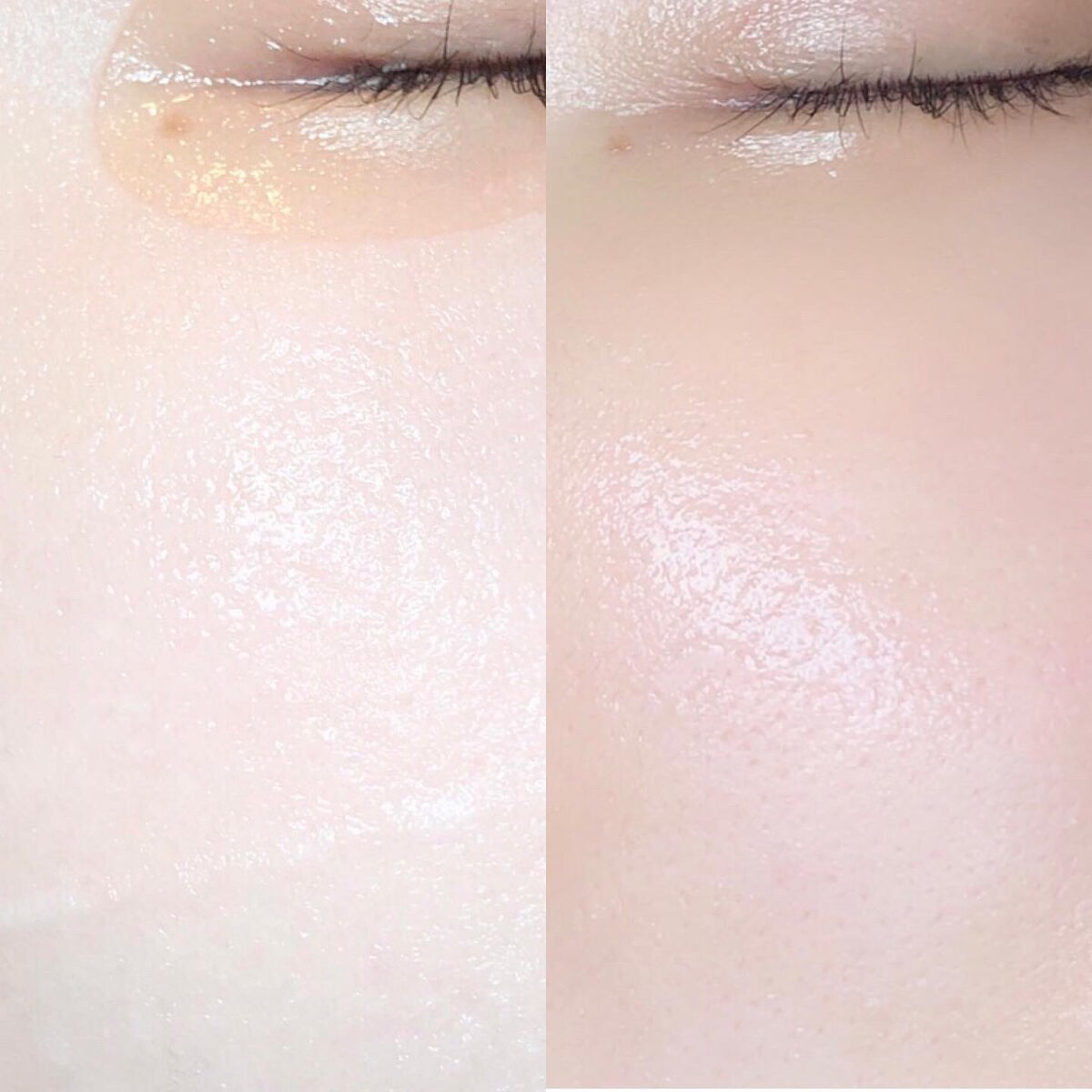 弱酸性pHシートマスク ドクダミフィット/Abib /シートマスク・パックを使ったクチコミ（3枚目）