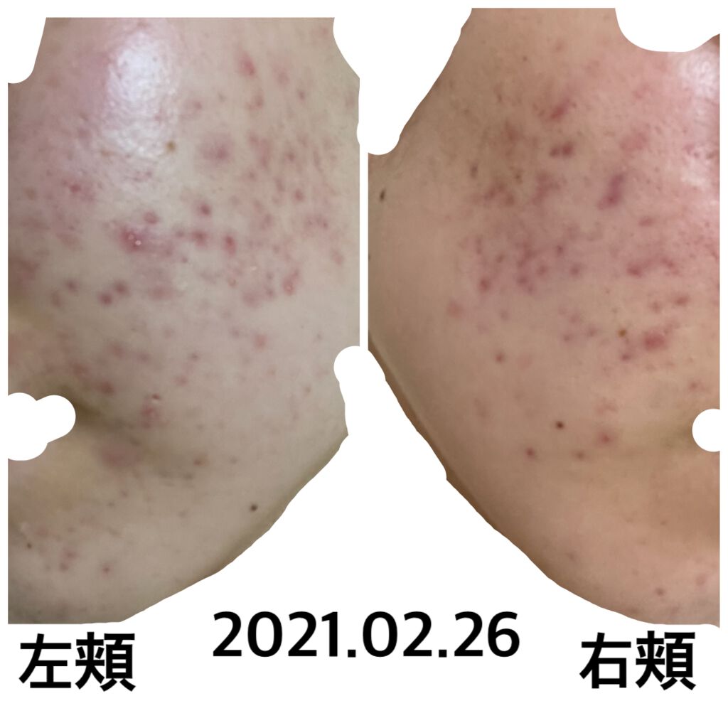 ビジャ シカバーム EX/innisfree/フェイスバームを使ったクチコミ（1枚目）