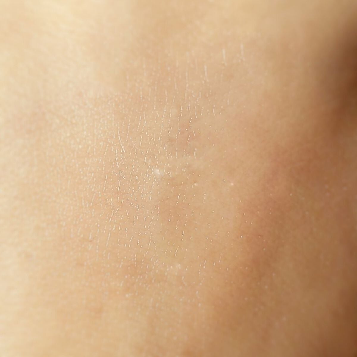 Noni Toner/celimax/化粧水を使ったクチコミ(5枚目)