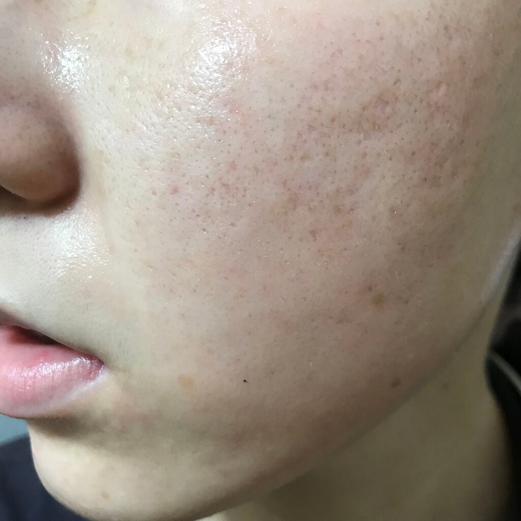 ティーツリーケア ソリューション エッセンシャルマスクEX/MEDIHEAL/シートマスク・パックを使ったクチコミ(2枚目)