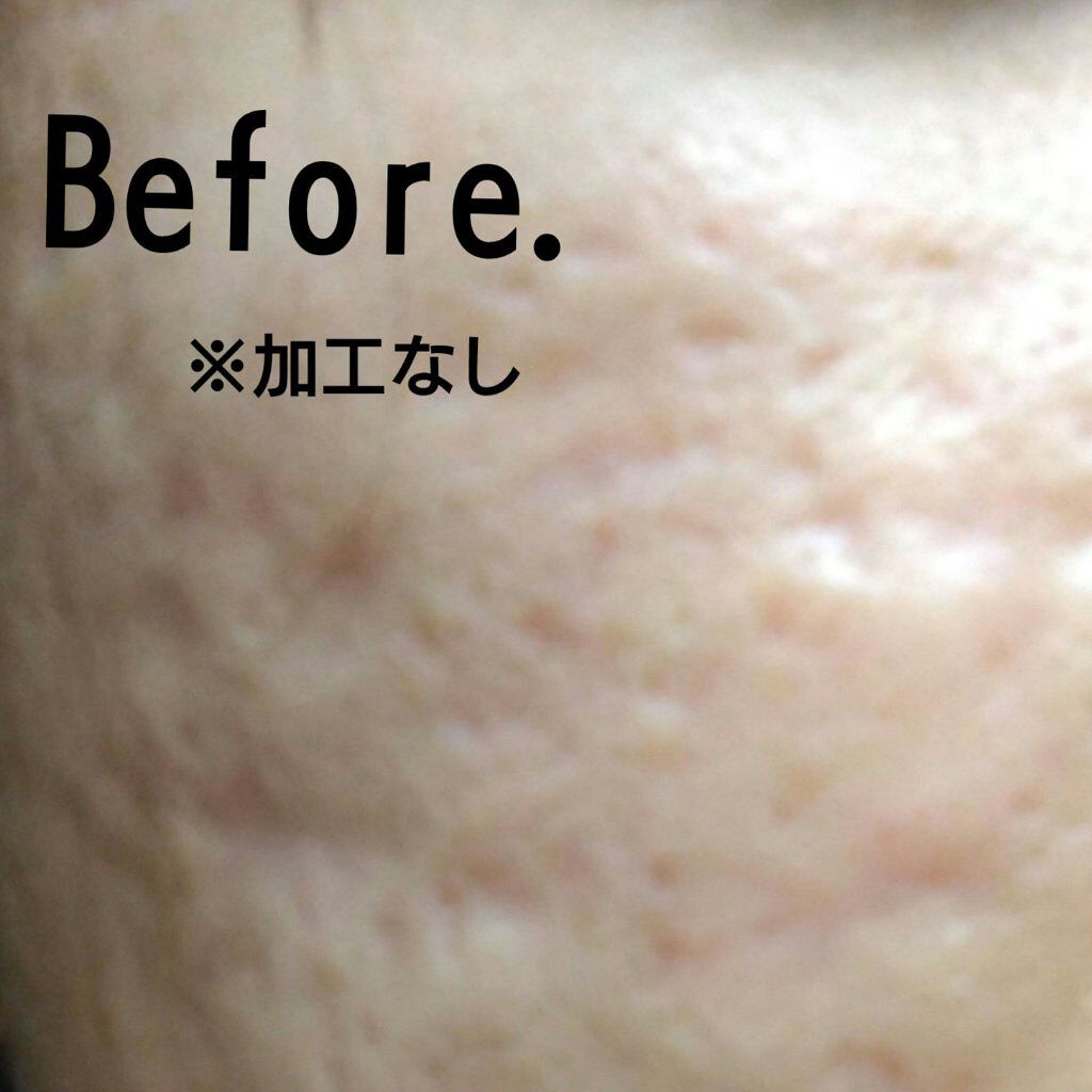 弱酸性pHシートマスク ドクダミフィット/Abib /シートマスク・パックを使ったクチコミ（2枚目）