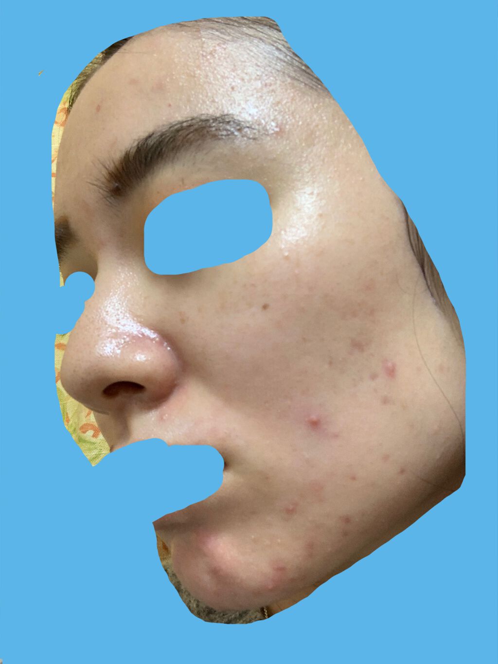 潤浸保湿 化粧水 III とてもしっとり/キュレル/化粧水を使ったクチコミ(5枚目)