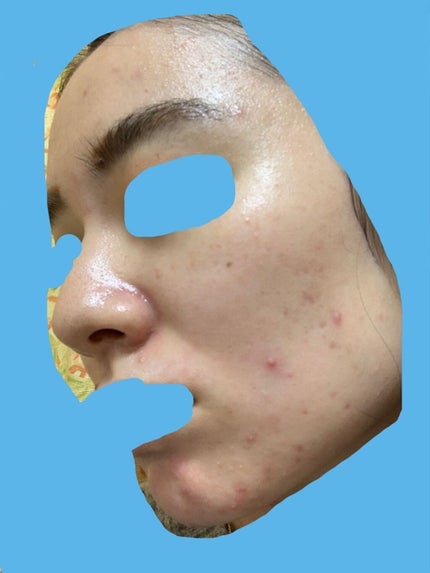 潤浸保湿 化粧水 III とてもしっとり/キュレル/化粧水を使ったクチコミ(5枚目)