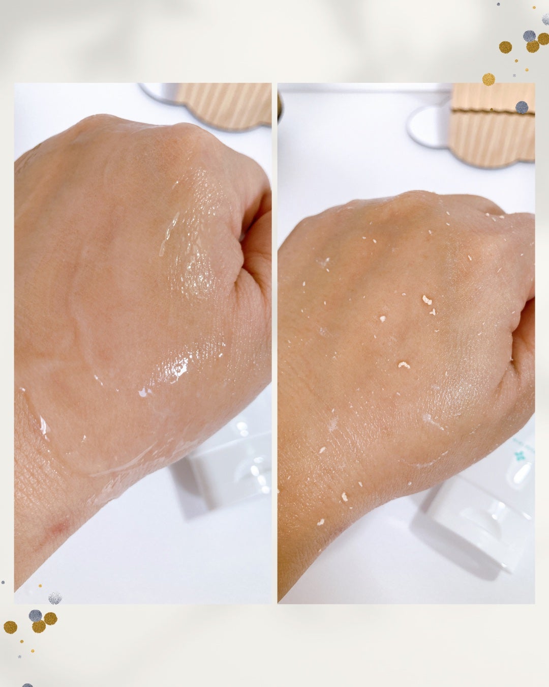 薬用アクネ角質ケアジェル/NIKI PITA/ピーリングを使ったクチコミ(3枚目)