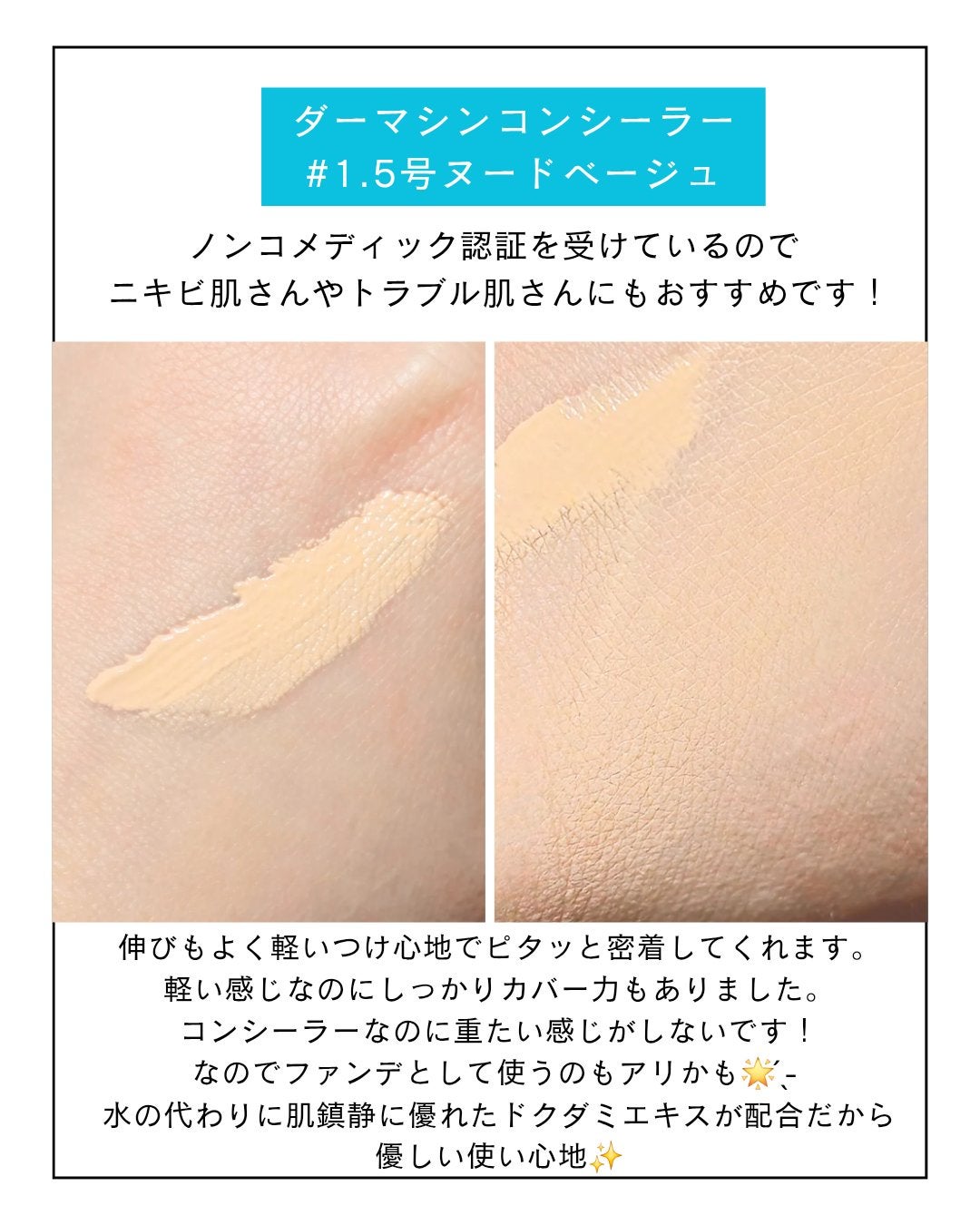 ダーマシンコンシーラー/23years old/リキッドコンシーラーを使ったクチコミ(4枚目)