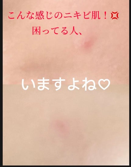 ガラクナイアシン2.0エッセンス/manyo/美容液を使ったクチコミ(2枚目)