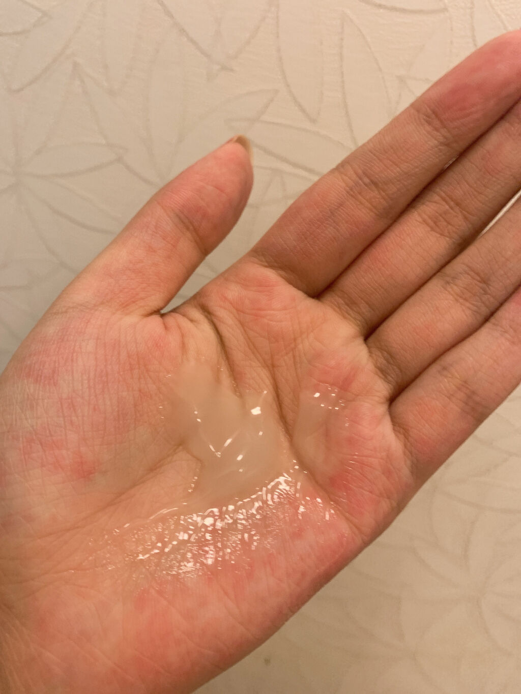 ボタニカル オールインワンゲル/ボタニカル/オールインワン化粧品を使ったクチコミ（2枚目）