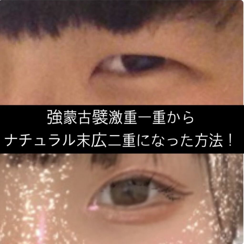 のびーるアイテープ（絆創膏タイプ、レギュラー）/DAISO/二重まぶた用アイテムを使ったクチコミ（1枚目）