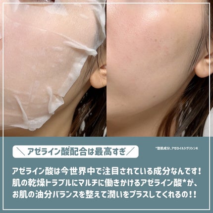 ルルルン ハイドラ AZ マスク/ルルルン/シートマスク・パックを使ったクチコミ(4枚目)