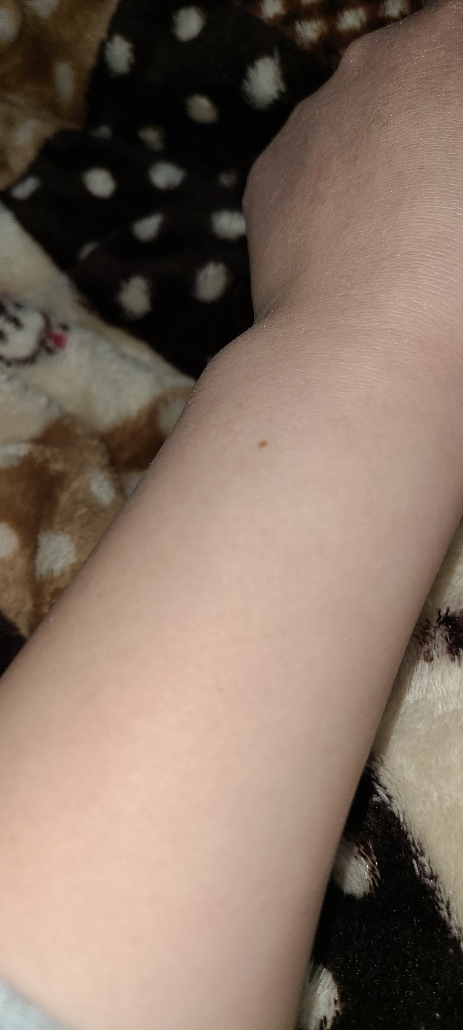 マジックコンシーラー ピンクベージュ/カリプソ/リキッドコンシーラーを使ったクチコミ（3枚目）